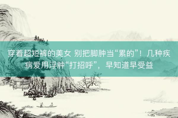 穿着超短裤的美女 别把脚肿当“累的”!几种疾病爱用浮肿“打招呼”,早知道早受益
